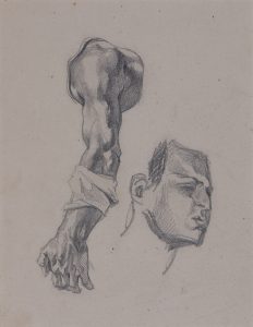 Study of a Head and Bandaged Arm